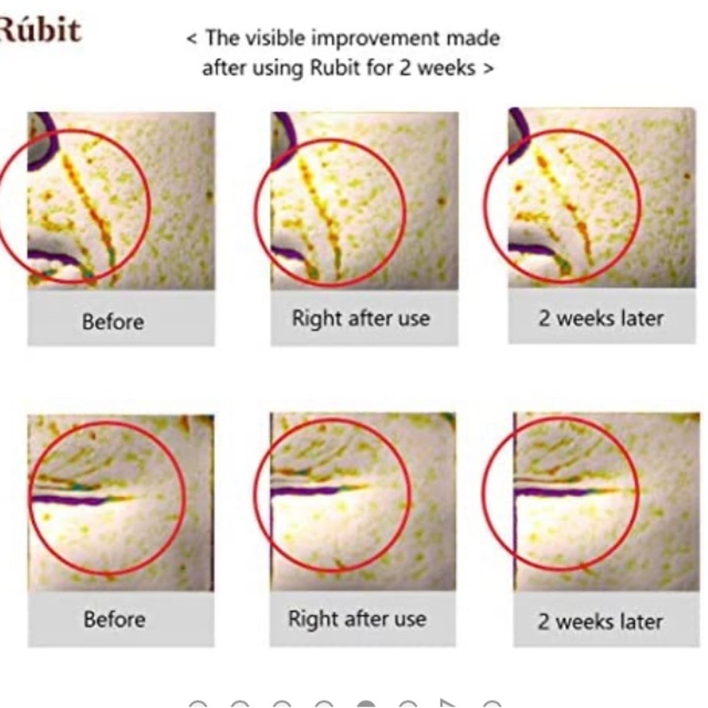 RUBIT Eye Wrinkle Care Ampoule Stick, REAL FRENCH Hydrolyzed COLLAGEN serum - Picture 2 of 6